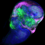 Image of stained imaginal disc of Drosophila