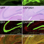 CAPON links Alzheimer’s plaques to neurodegeneration