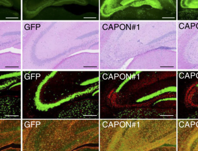 CAPON links Alzheimer’s plaques to neurodegeneration