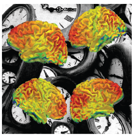 Brain clock ticks differently in autism