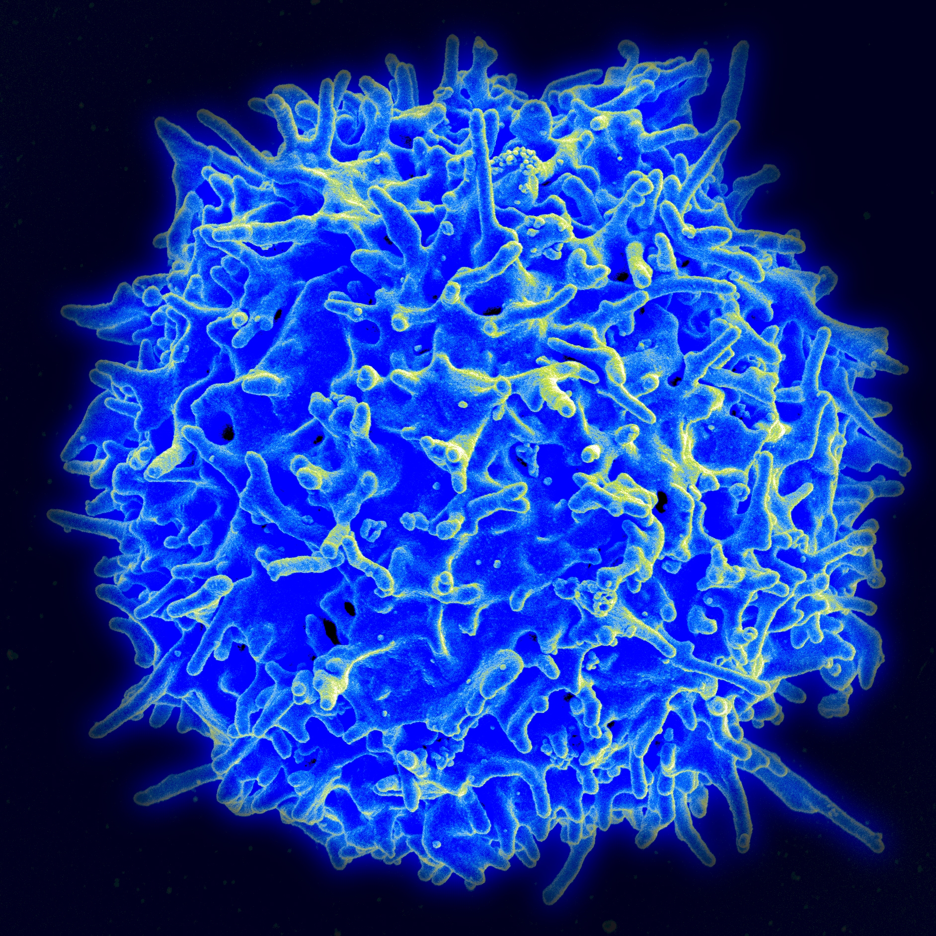 image of a T-cell