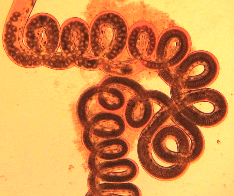 A gut-wrenching defense against parasitic worms
