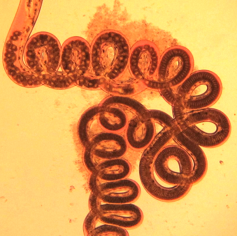 A gut-wrenching defense against parasitic worms