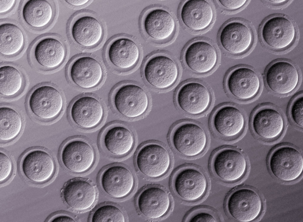 Scanning electron micrograph of mouse oocytes