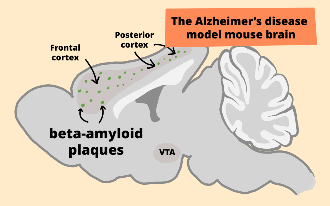 Dopamine reduces beta-amyloid plaques in Alzheimer’s disease