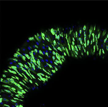 Stem cell exhaustion and proliferation: An aging fly’s tale