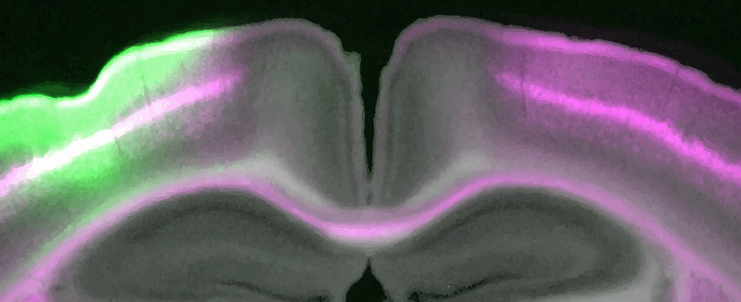 Microcolumns: elementary neuronal units that carpet the (mouse) brain