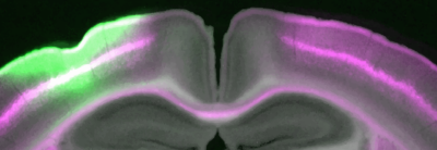 Microcolumns: elementary neuronal units that carpet the (mouse) brain