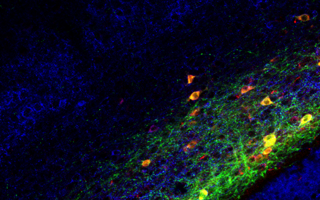 Consciousness, brain connections, and the claustrum