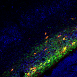claustrom neurons