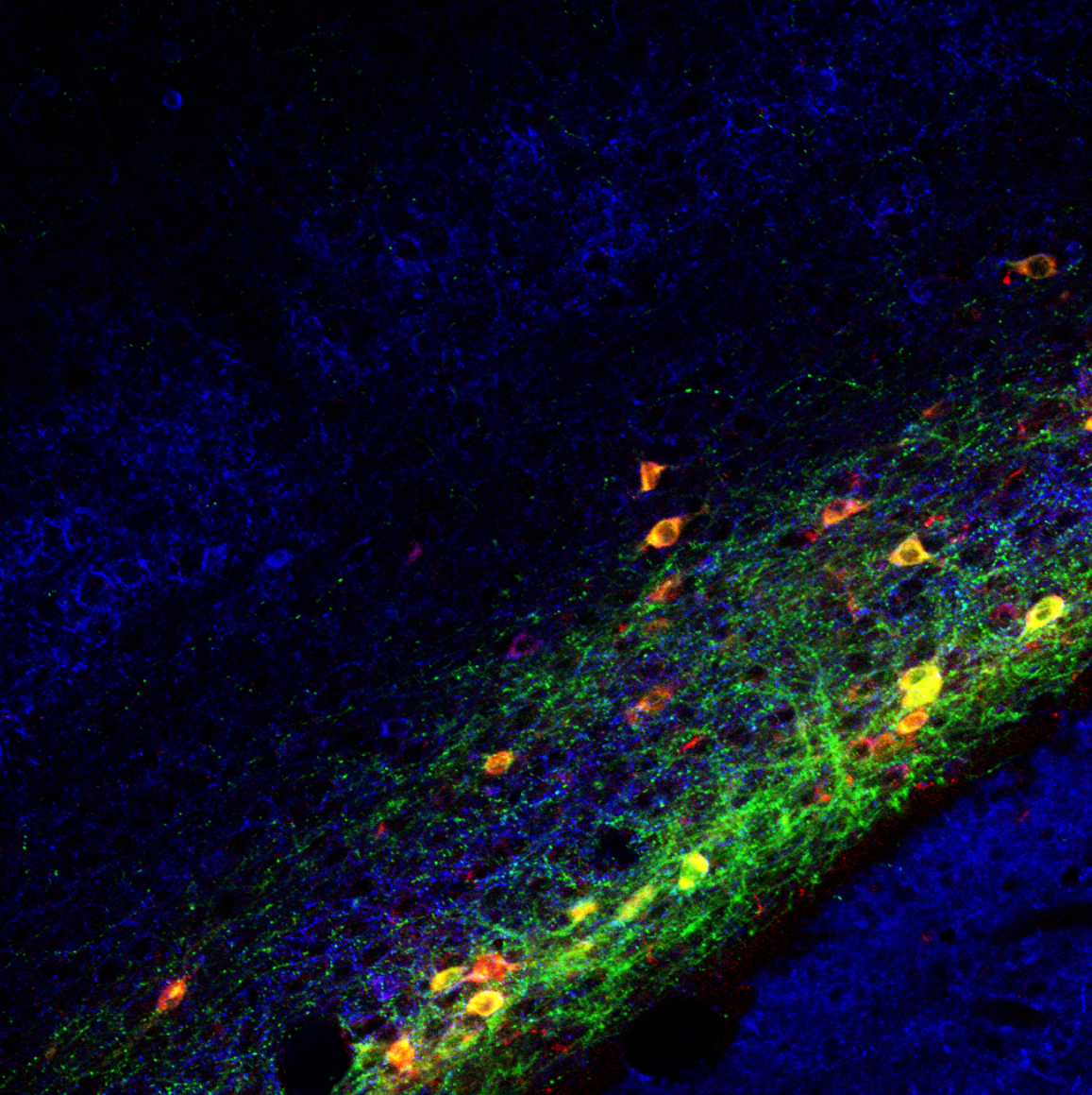 Consciousness, brain connections, and the claustrum