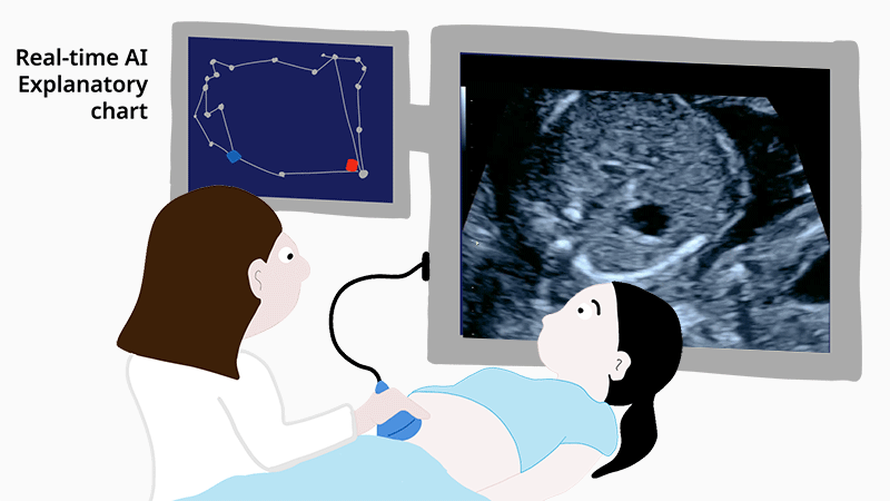 Doctors use AI to analyze ultrasound video for fetal heart problems