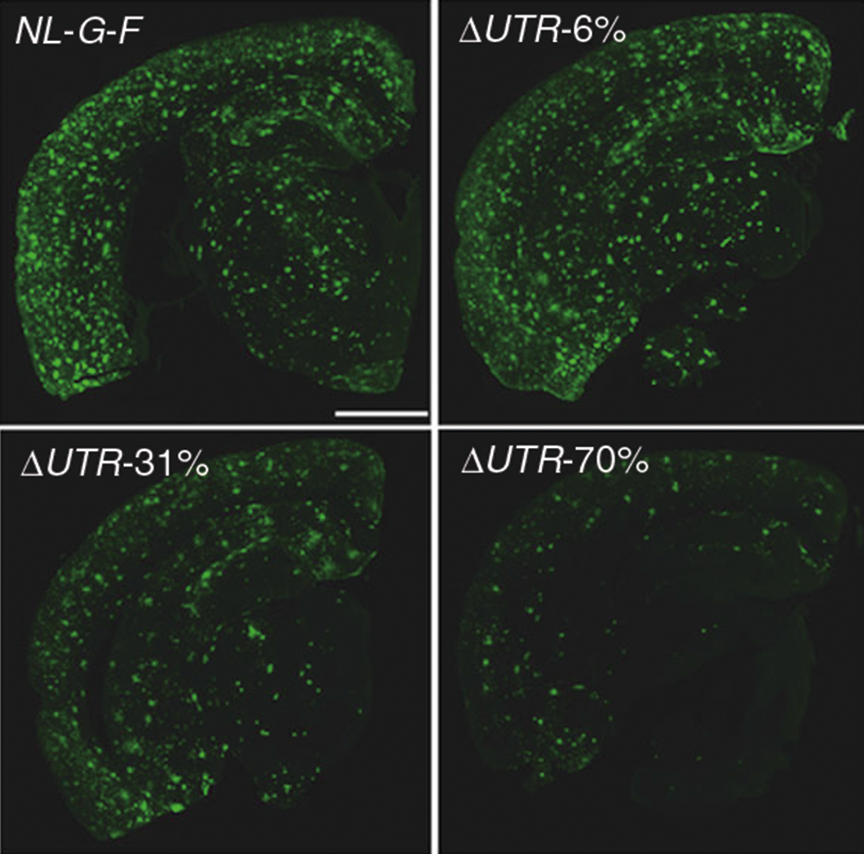 Mutation protects against Alzheimer’s disease in mice