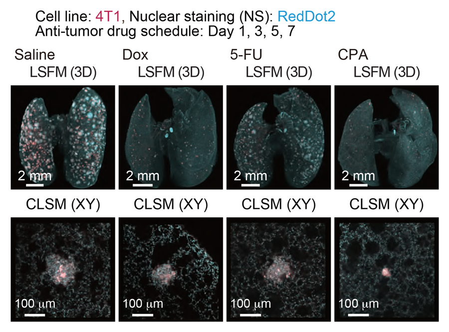 cancer metastasis in lungs imaged at the single-cell level
