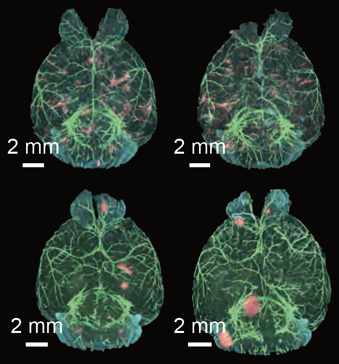 Imaging whole-body cancer metastasis at the single-cell level