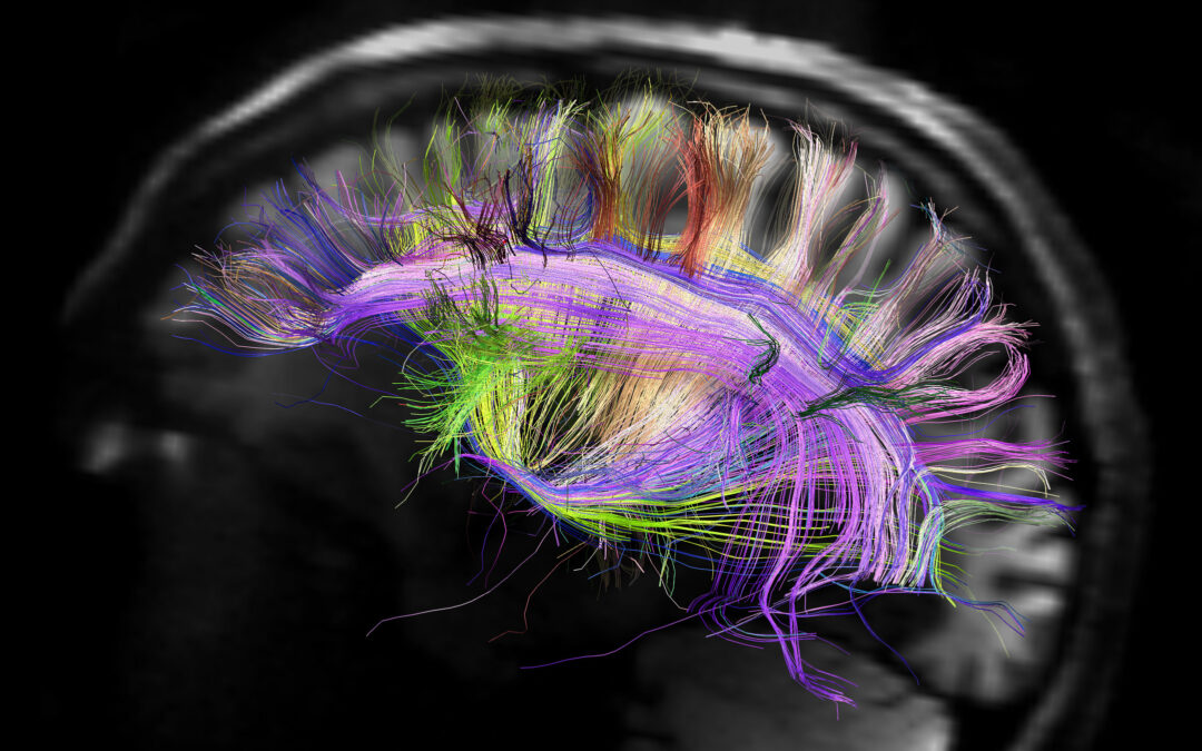 Rainbow engineering to make the brain glow