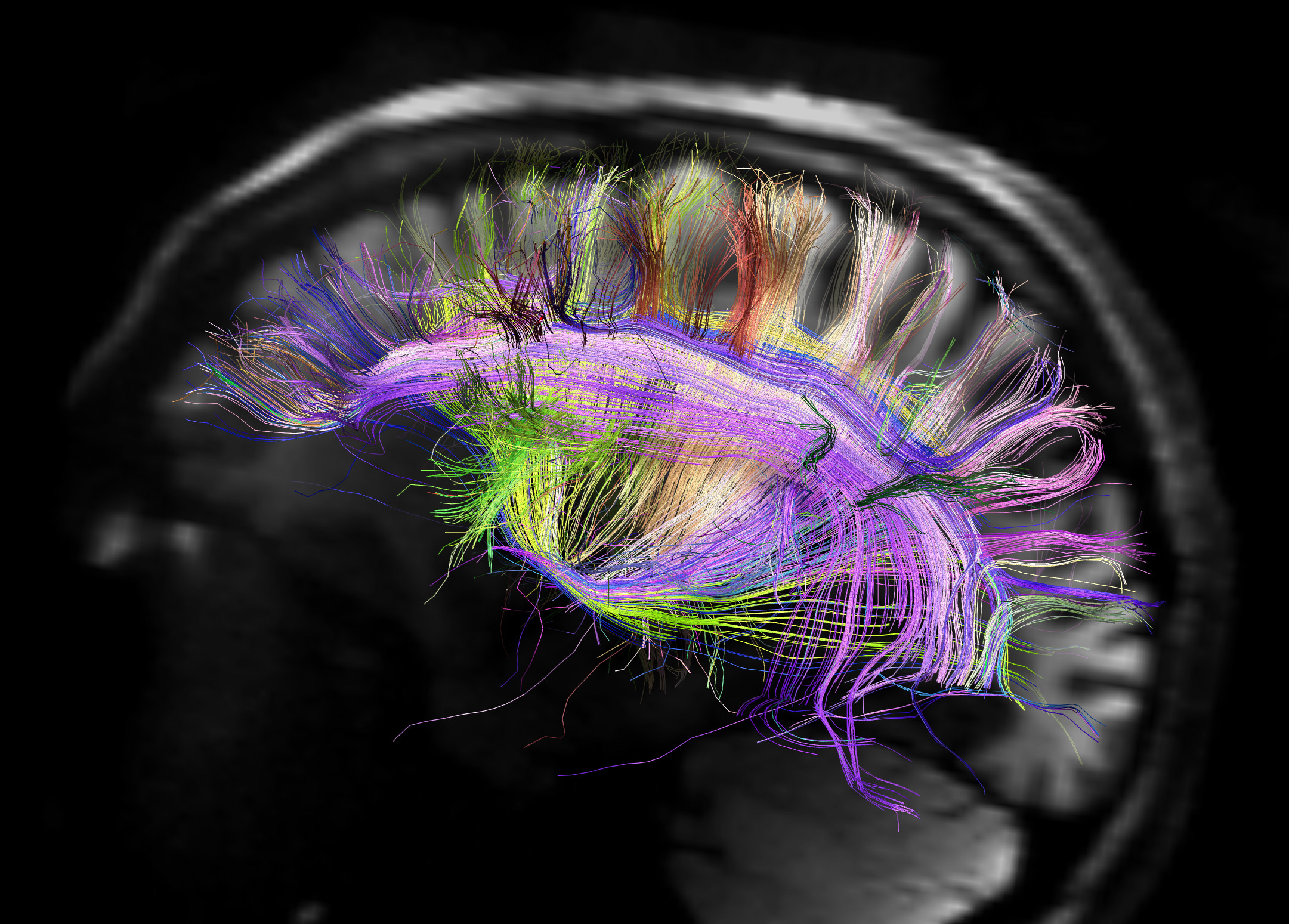 Rainbow engineering to make the brain glow