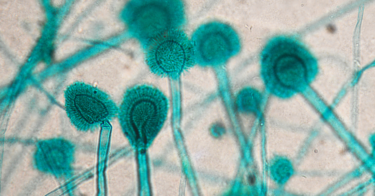 Aspergillus under a microscope