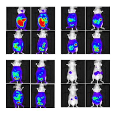 Cancer cells killed with artificial glycosylated metalloenzyme