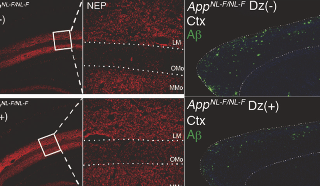 Diazoxide pills for Alzheimer’s disease?